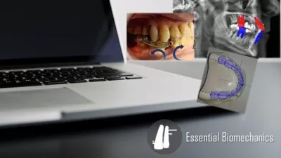 Introduction to Orthodontic Biomechanics