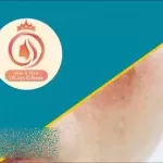 Mastering Sensitive And Damaged Skin: Science To Practice