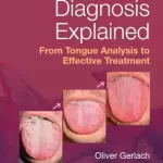 TCM Tongue Diagnosis Explained: From Tongue Analysis to Effective Treatment